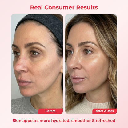 PDRN Deep Mask (4 Masks).